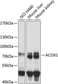 Anti-ACOX1 antibody used in Western Blot (WB). GTX32989