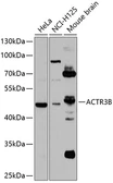 Anti-ACTR3B antibody used in Western Blot (WB). GTX32990