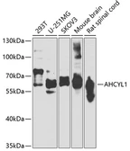 Anti-AHCYL1 antibody used in Western Blot (WB). GTX32996