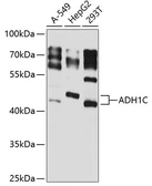Anti-Alcohol dehydrogenase 1C antibody used in Western Blot (WB). GTX32997