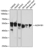 Anti-ALDH1B1 antibody used in Western Blot (WB). GTX32998