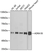 Anti-alpha 1b Adrenergic Receptor antibody used in Western Blot (WB). GTX33003