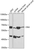 Anti-alpha Internexin antibody used in Western Blot (WB). GTX33004