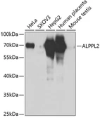 Anti-ALPPL2 antibody used in Western Blot (WB). GTX33005