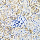 Anti-AMPK gamma 1 antibody used in IHC (Paraffin sections) (IHC-P). GTX33006