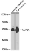 Anti-alpha amylase 2A (pancreatic) antibody used in Western Blot (WB). GTX33007
