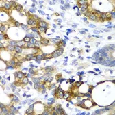 Anti-Pancreatic alpha Amylase antibody used in IHC (Paraffin sections) (IHC-P). GTX33007