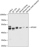 Anti-AP1M2 antibody used in Western Blot (WB). GTX33012