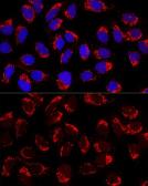 Anti-AP1M2 antibody used in Immunocytochemistry/ Immunofluorescence (ICC/IF). GTX33012
