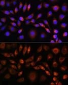 Anti-Apolipoprotein M antibody used in Immunocytochemistry/ Immunofluorescence (ICC/IF). GTX33015