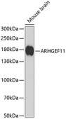 Anti-ARHGEF11 antibody used in Western Blot (WB). GTX33017