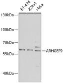 Anti-ARHGEF9 antibody used in Western Blot (WB). GTX33018