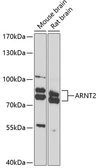 Anti-ARNT2 antibody used in Western Blot (WB). GTX33019