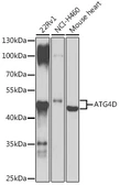 Anti-ATG4D antibody used in Western Blot (WB). GTX33025