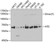 Anti-ATIC antibody used in Western Blot (WB). GTX33026