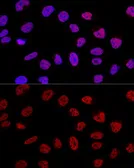 Anti-BCAS2 antibody used in Immunocytochemistry/ Immunofluorescence (ICC/IF). GTX33035