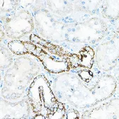 Anti-BCAT2 antibody used in IHC (Paraffin sections) (IHC-P). GTX33036