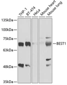 Anti-Bestrophin 1 antibody used in Western Blot (WB). GTX33037