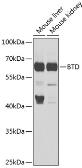 Anti-BTD antibody used in Western Blot (WB). GTX33046