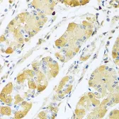 Anti-C4 binding protein B antibody used in IHC (Paraffin sections) (IHC-P). GTX33051