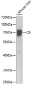 Anti-C9 / C9a antibody used in Western Blot (WB). GTX33054