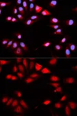 Anti-Calcipressin 1 antibody used in Immunocytochemistry/ Immunofluorescence (ICC/IF). GTX33055