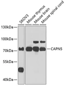 Anti-Calpain 5 antibody used in Western Blot (WB). GTX33057