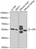 Anti-Carboxypeptidase E antibody used in Western Blot (WB). GTX33060