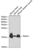 Anti-Cardiac Troponin C antibody used in Western Blot (WB). GTX33061