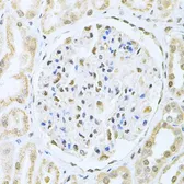 Anti-CBFb antibody used in IHC (Paraffin sections) (IHC-P). GTX33066