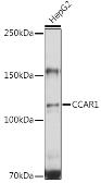 Anti-CCAR1 antibody used in Western Blot (WB). GTX33069