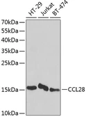 Anti-CCL28 antibody used in Western Blot (WB). GTX33070