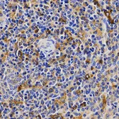 Anti-CCRK antibody used in IHC (Paraffin sections) (IHC-P). GTX33072