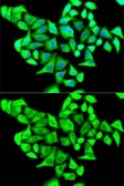 Anti-CD22 antibody used in Immunocytochemistry/ Immunofluorescence (ICC/IF). GTX33075
