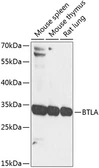 Anti-CD272 antibody used in Western Blot (WB). GTX33076