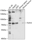 Anti-CD290 / TLR10 antibody used in Western Blot (WB). GTX33077