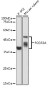 Anti-CD32a antibody used in Western Blot (WB). GTX33078