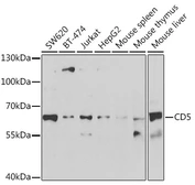 Anti-CD5 antibody used in Western Blot (WB). GTX33079