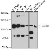 Anti-CDH11 antibody used in Western Blot (WB). GTX33082
