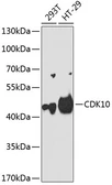 Anti-CDK10 antibody used in Western Blot (WB). GTX33084