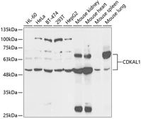 Anti-CDKAL1 antibody used in Western Blot (WB). GTX33087