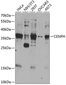 Anti-CENPH antibody used in Western Blot (WB). GTX33090