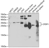 Anti-CFDP1 antibody used in Western Blot (WB). GTX33092