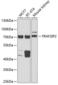 Anti-CIKS antibody used in Western Blot (WB). GTX33095