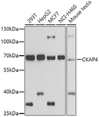 Anti-CKAP4 antibody used in Western Blot (WB). GTX33097