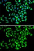 Anti-CLASP1 antibody used in Immunocytochemistry/ Immunofluorescence (ICC/IF). GTX33099