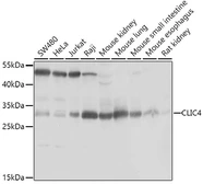 Anti-CLIC4 antibody used in Western Blot (WB). GTX33100