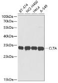 Anti-CLTA antibody used in Western Blot (WB). GTX33101