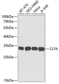 Anti-CLTA antibody used in Western Blot (WB). GTX33101