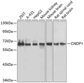 Anti-CNDP1 antibody used in Western Blot (WB). GTX33103